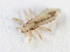head lice