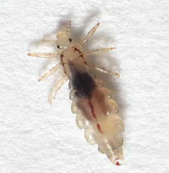 head louse